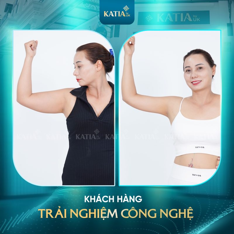 Thẩm mỹ viện Katia có uy tín không