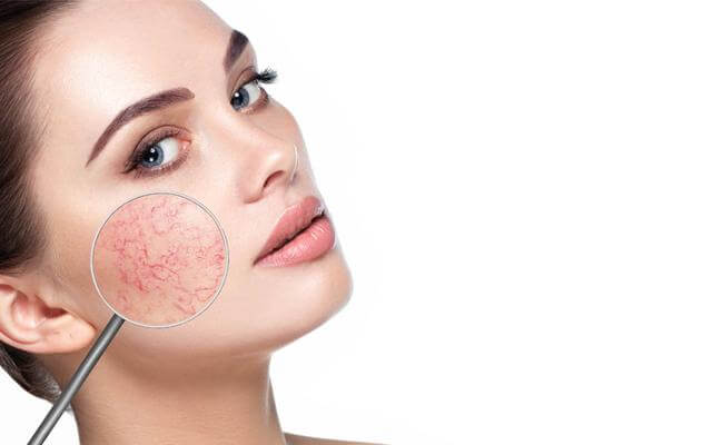 Các bước chăm sóc da mặt nhạy cảm giúp bạn “đẹp mỗi ngày”