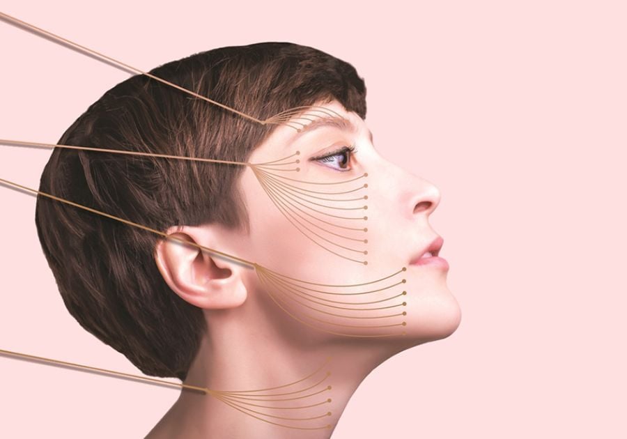 Phân biệt 3 loại chỉ căng da mặt & cách lựa chọn chỉ phù hợp