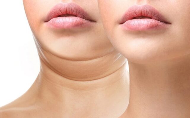 Những trái cây giảm cân